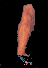 Fire Pillar
