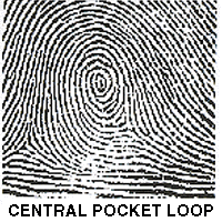 Central Pocket Loop