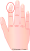 Finger 1 Bent
